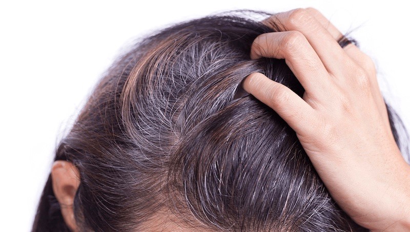 Tóc bạc sớm do đâu, khắc phục như thế nào?